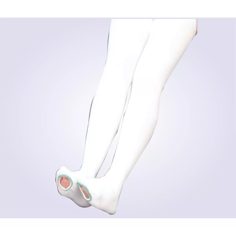 2 Medias Antiembólicas Muslo Alto/talla Mediana/envio Gratis