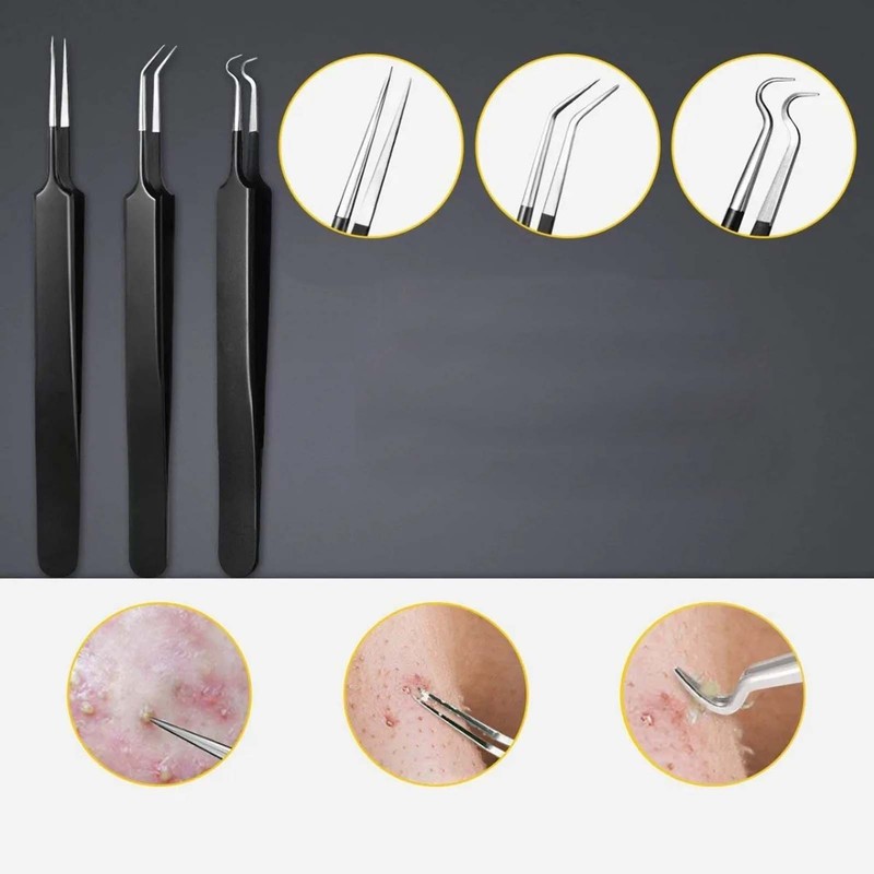10pcs Pimples Needles Carbon Steel Portable Blackheads Removal Multifunctional Face
