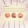 Plstod Blackhead Remover, Pimple Squeezing Tool, Blackhead Remover Set, for
