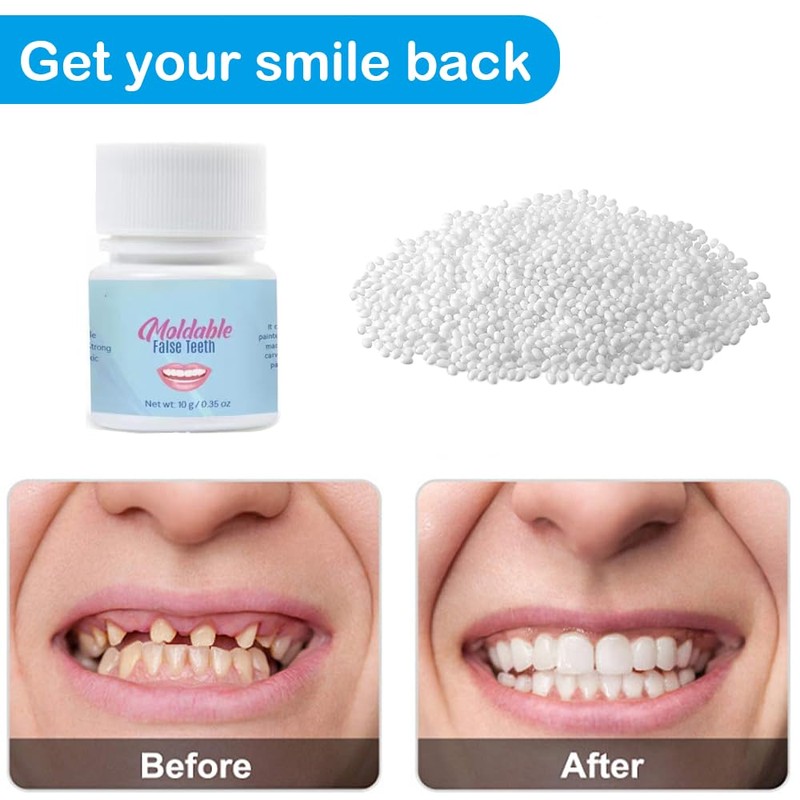 Temporary Teeth Repair Kit - Teeth replacement kit for temporary