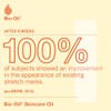 Bio-Oil Natural Skincare Oil for Scars and Stretch Marks, 200ml