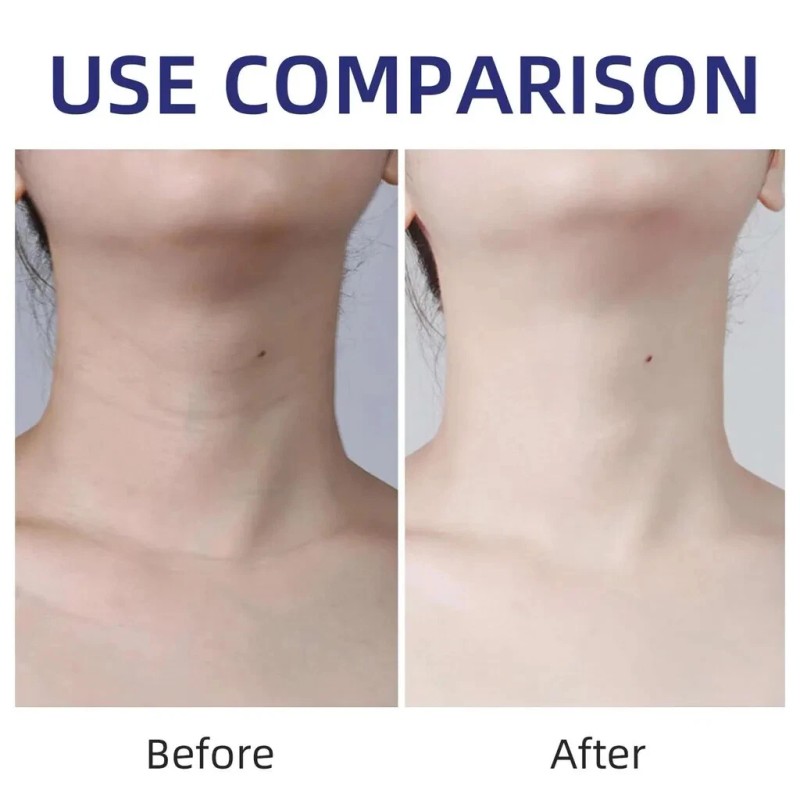 Neck Cream - Tighten & Lift Firming Neck Cream for