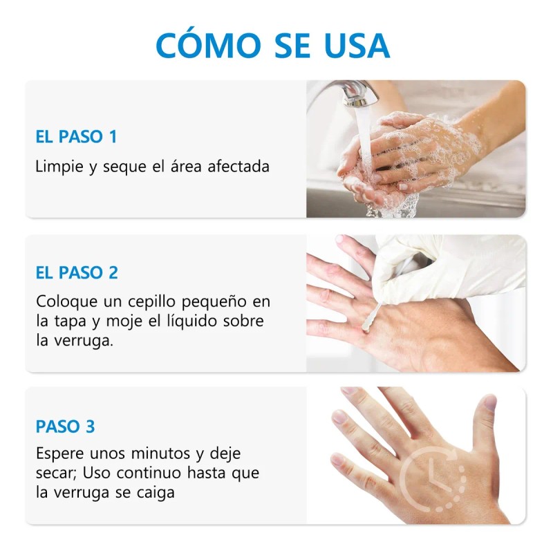 Líquida Eliminación De Verrugas,verrugas Plantare Y Comune