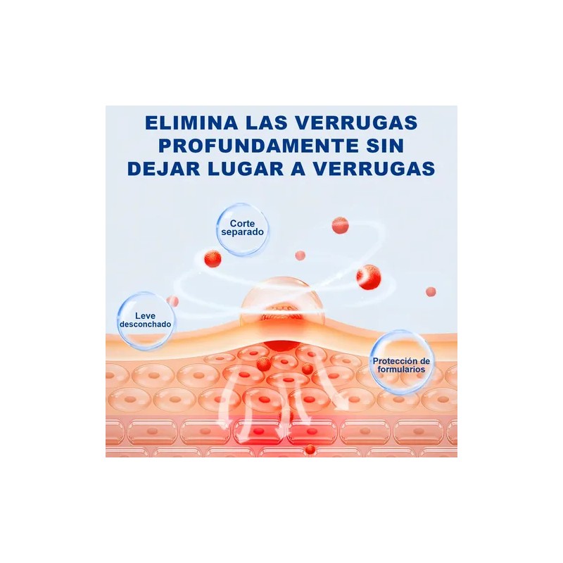 Crema Para Verrugas Elimina Eficazmente Y Cuida La Piel 20g