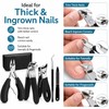 5-Piece Ingrown Toenail Tool Kit for Thick Nails – Curved