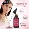 Generic Rosehip Oil for Face, Certified Organic Rosehip Oil, use