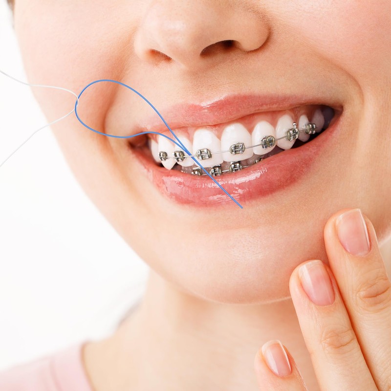 Bopika Floss Threaders Dental Floss for Braces, Bridges, and Implants