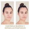 2 Cremas Anti Acné, Reduce Manchas, Control Grasa. Mc Life