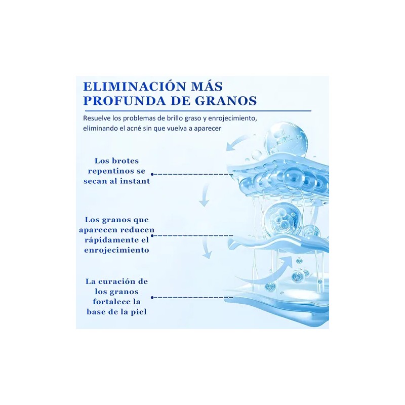 Acne Buster Loción Secante Con Ácido Salicílico 10ml