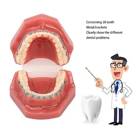 Modelo de Dientes de Ortodoncia de Tipodonto (28 Piezas de Dientes)-Dentición Llena de Pantalla Completa, Maloclusión, Mandíbula Abierta