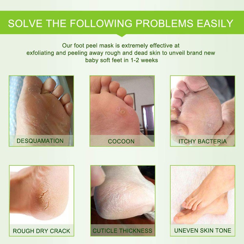 5 Pairs Foot Mask Callus Socks Foot Peel Off Mask