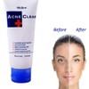 Mistine Acne Clear Facial Foam 85g
