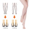 3-Layers Overpronation Insoles, Adjustable Heel Wedge Corrective Inserts, Correct Excessive