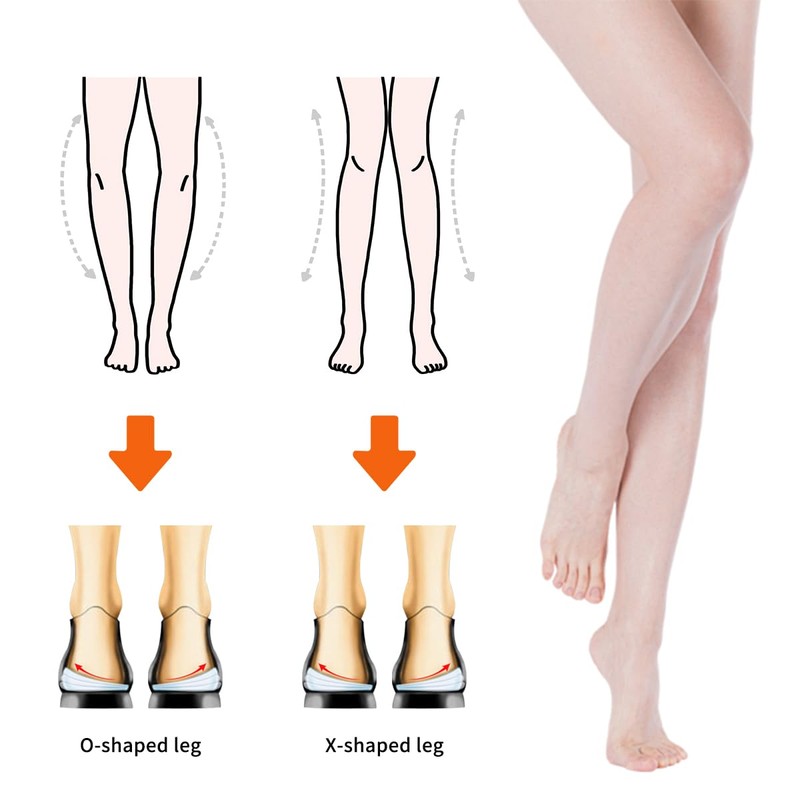 3-Layers Overpronation Insoles, Adjustable Heel Wedge Corrective Inserts, Correct Excessive