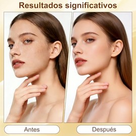 Crema Reafirmante para el Cuello, Crema Reafirmante para el Cuello con Doble Rodillo, Reduce Arrugas, Líneas Finas y Papada, Reafirma la Piel.
