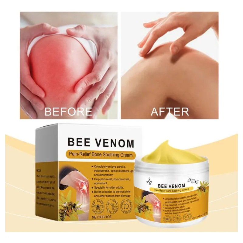 Crema Tópica Para El Cuidado De Las Articulaciones Con Venen