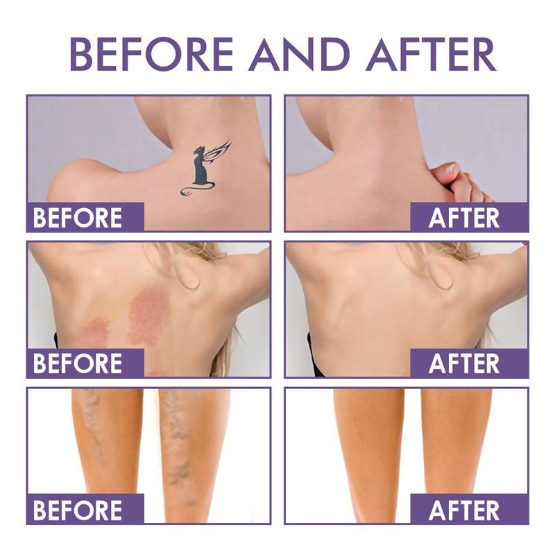 Eazerom 24 Tattoo Concealer for Body, Tattoo Cover Cream, Tattoo