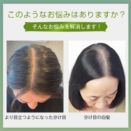 YOYO Partial Wig, 100% Human Hair, Anti-Thin, Breathable, Long, Top Cover, For Parts, Real Artificial Scalp, For Women, Hidden Gray Hair, Lightweight, Easy to Install, Net Size 1.8 x 5.1 inches (4 x