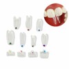 10 pcs/Pack Dental Clear Matrix Anterior Posterior Fit Bioclear BT
