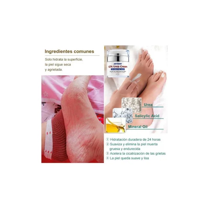 Artken Reparación Para Pies Agrietados Y Resecos - Crema