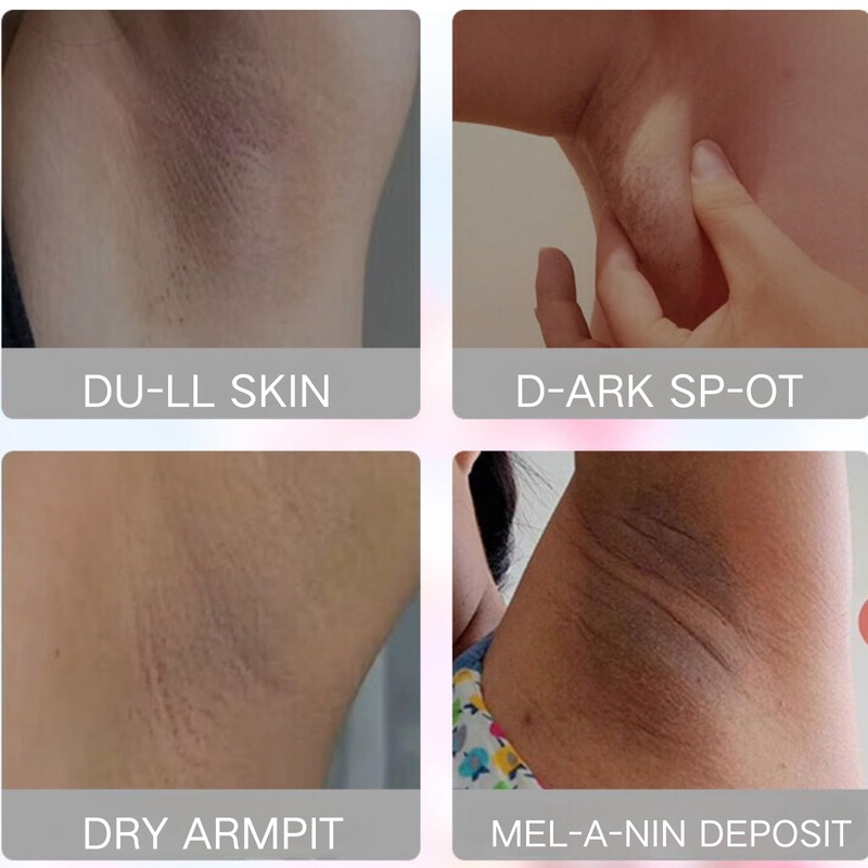 MrCuvaryas Kojic Acid Underarm Cream for Underarms