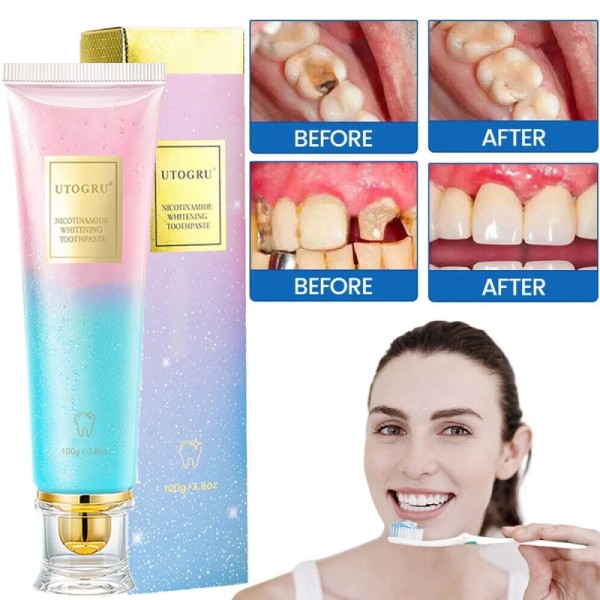 UTOGRU Niacinamide Intensive Whitening Toothpaste, Remove Tooth Stains, Fresh Breath