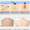Body Brush, Foldable, Back Acne Treatment, Gentle Keratolytic Care, Back