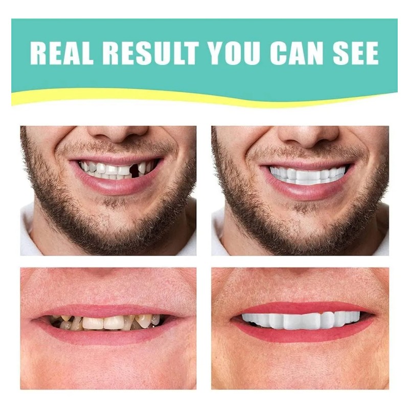 Carillas Dentales Tiras Blanqueadoras Dientes Postizos