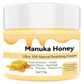 Max Strength Treat - Pomada de crema de miel de manuka orgánica natural, alivio calmante para piernas, estómago, axilas, pies, manos, seco, erupción p