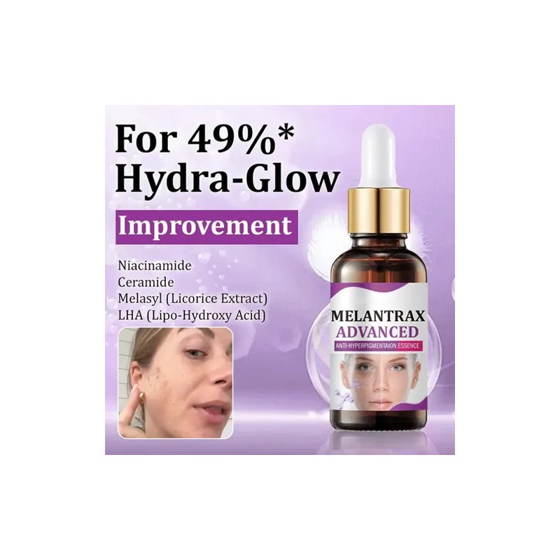Highly Effective Anti-pigmentation Serum Whitening Blemish R