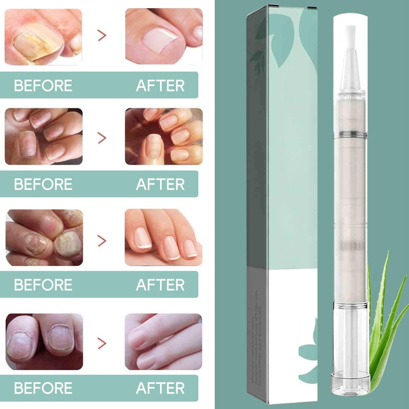Pack of 5 Nail Care Pen, Nail Oil Pen, Routine