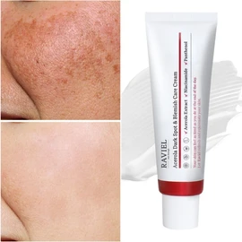 [19% Improvement in Melasma in 3 Days / 500,000 Units Sold Cumulatively] Laviel Acerola Blemish & Melasma Care Cream 50ml (4 Pieces) / [3일기미 19%개선/누적50만개 판매] 라비엘 아세로라 잡티 기미 케어 크림 50ml 4개