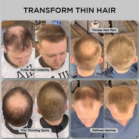 THICK FIBER Hair Fibers for Thinning Hair & Bald spots (LIGHT BROWN) - 25g Bottle - Conceals Hair Loss in Seconds - Hair Powder for Women & Men