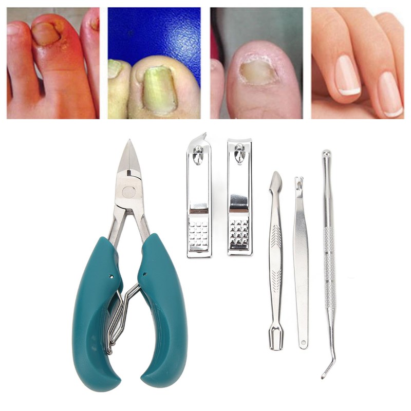 7pcs Nail Clippers Set Dead Skin Fork Paronychia Forceps Nail