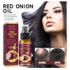 Aceite De Cebolla Para El Crecimiento Del Cabello 2pz ,w/