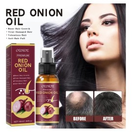 Aceite De Cebolla Para El Crecimiento Del Cabello 2pz ,w/