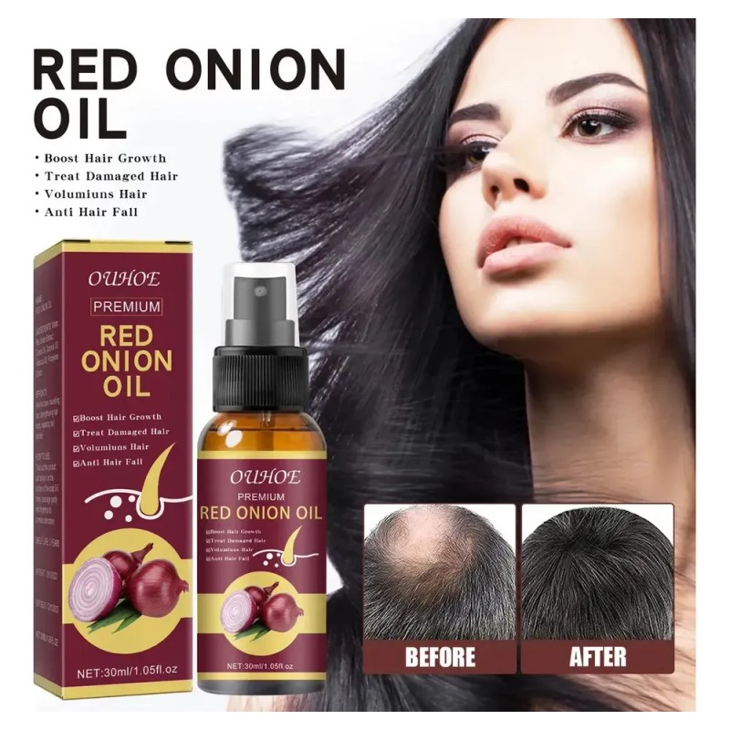 Aceite De Cebolla Para El Crecimiento Del Cabello 2pz ,w/