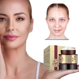 Crema Despigmentante De Manchas Paño Melasma Pecas Blanquea