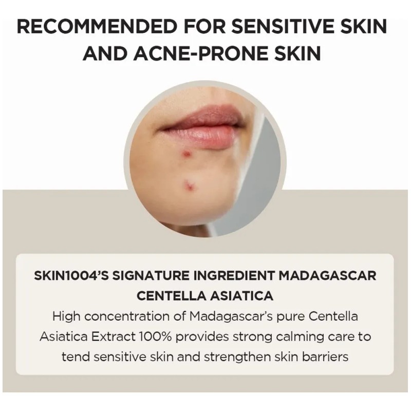 Skin1004 Madagascar Centella Ampoule 30ml - Todo Tipo De Piel