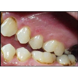 Viset Niyom Herbal Tooth Powder Thai Original Traditional Toothpaste