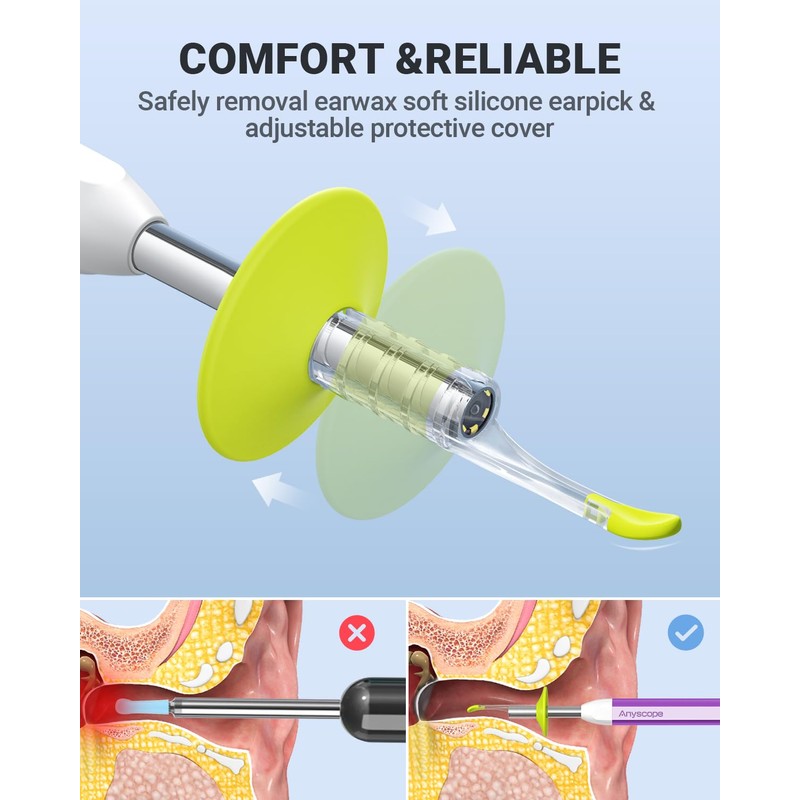 AnyScope AnyScope Digital Otoscope with Gyroscope, HD Ear Camera with