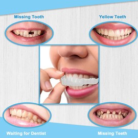 1 Pair Fake Braces Temporary Braces Autogenic Braces Upper and Lower Fake Smile Braces Cosmetic Mouth Guard
