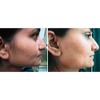 Episiva Natural Hair Reducing Cream for Face and Body Includes