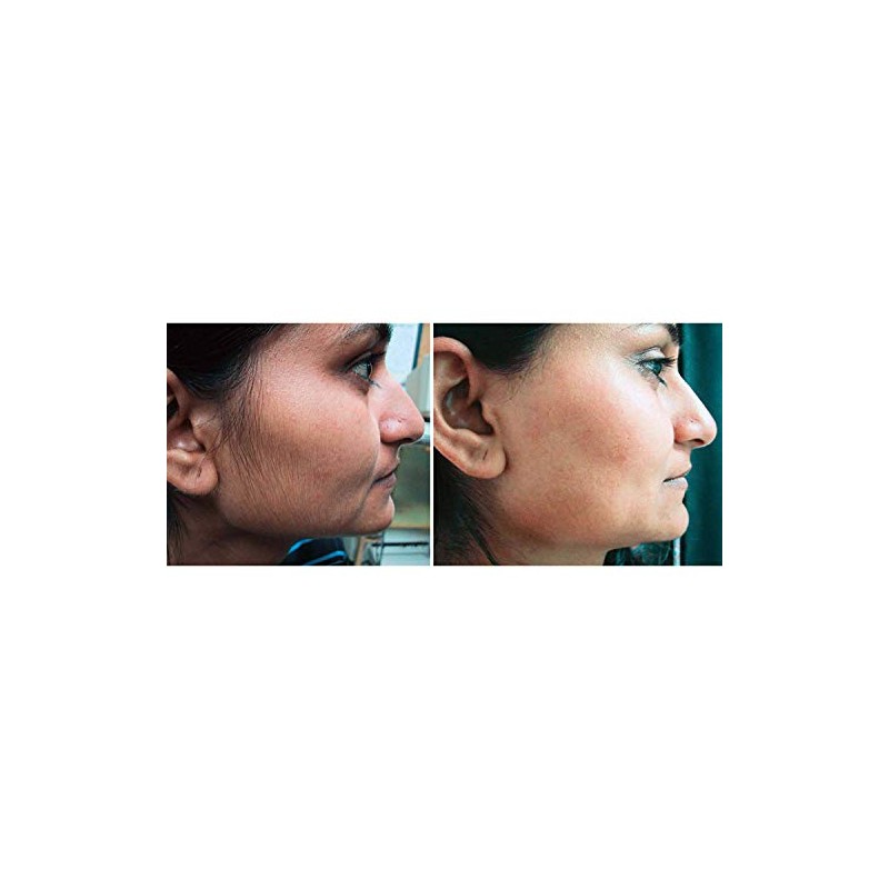 Episiva Natural Hair Reducing Cream for Face and Body Includes