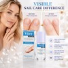 Vitry Nail Repair Treatment
