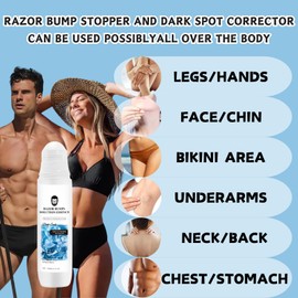 SHEBEEDO SHEBEEDO Razor Bumps Treatment For Men And Women Ingrown Hair Solution Post Shave Balm Unisex Skin Care Agent