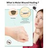 Hydrocolloid Roll for Wound Care - Cut-to-Size, Extra Large Medical-Grade