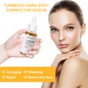 Turmeric Serum, Turmeric Serum for Correcting Dark Spots, Repair Serum