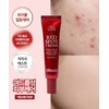 Acne clinical trial completed) Red Spot Cream |Vegan & Non-comedogenic
