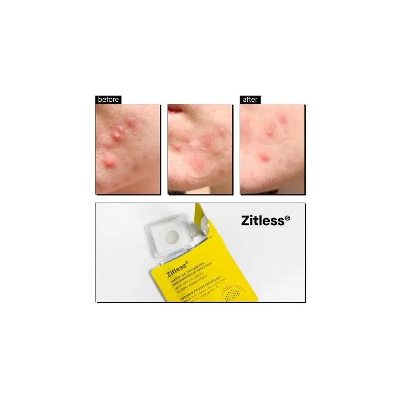 Acnemy Zitless Microdart Pimple Patches